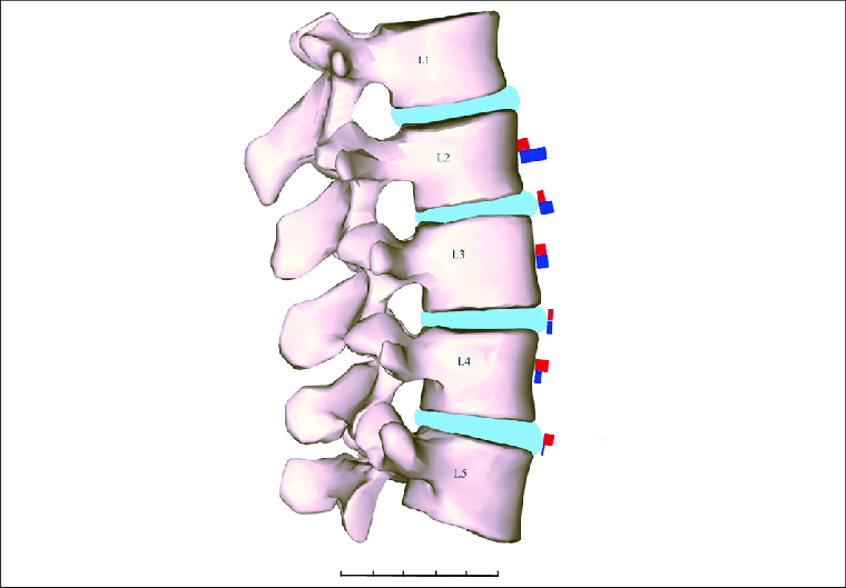 Vertebrae spacing